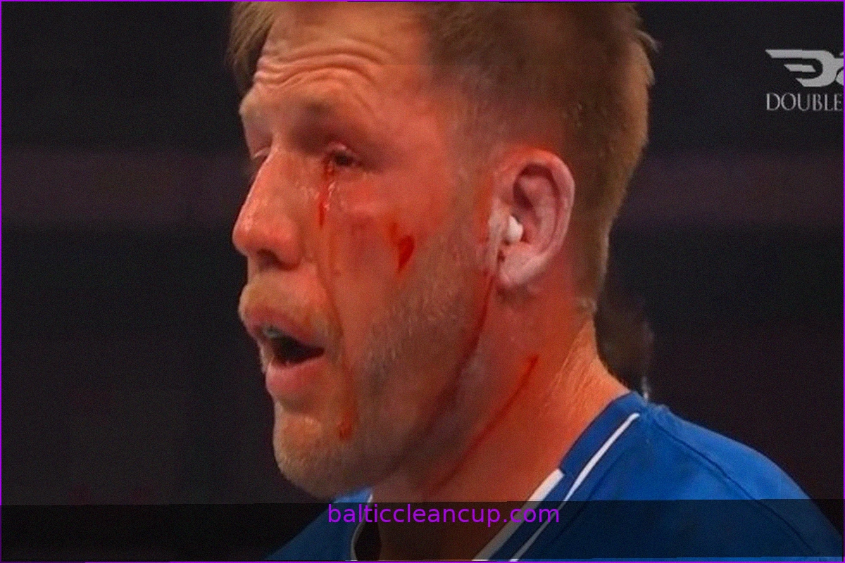 Jake Hager Suffers Eye Injury in Power Slap Match