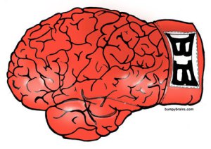 Preview Huni Plans To Spoil Wardley Homecoming With Boxing Brain