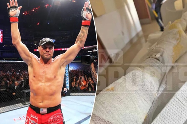 Preview UFC Hall of Famer Randy Couture Injured in Serious Racing Incident