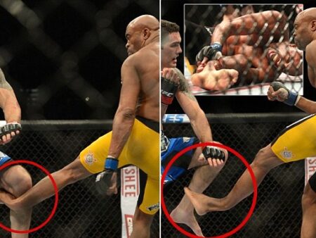 Anderson Silva’s Clinical Question: The Defining Moment of True Fighter Resilience After Catastrophic Injury